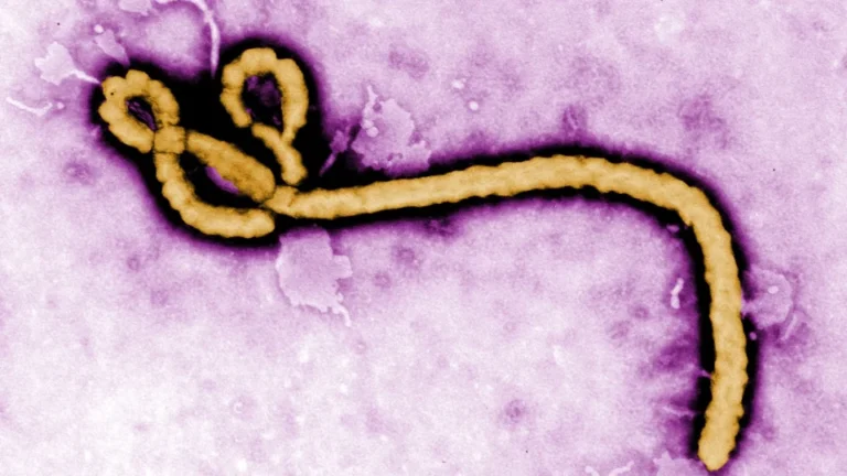Just In: FG Confirms Ebola Case in Abuja, Identifies 44 Contacts as Health Authorities Intensify Surveillance